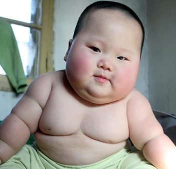 obese infant