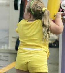 obese child